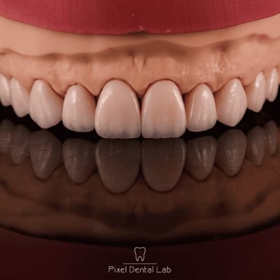 Coroane dentare albe, textură detaliată, reflectate pe suprafață.