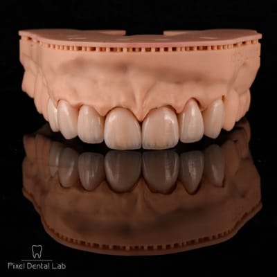 Model protetică dentară cu fațete ceramice reflectat pe suprafață.