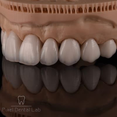 Model digital dantură cu fațete dentare albe, lustruite.