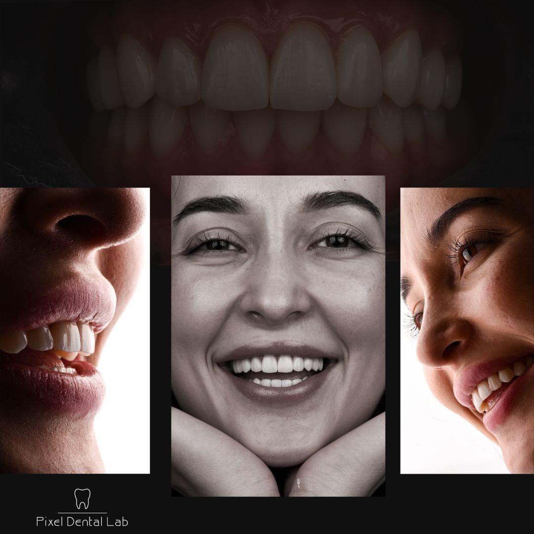 Trei imagini ale unei persoane zâmbitoare, dinți albi.