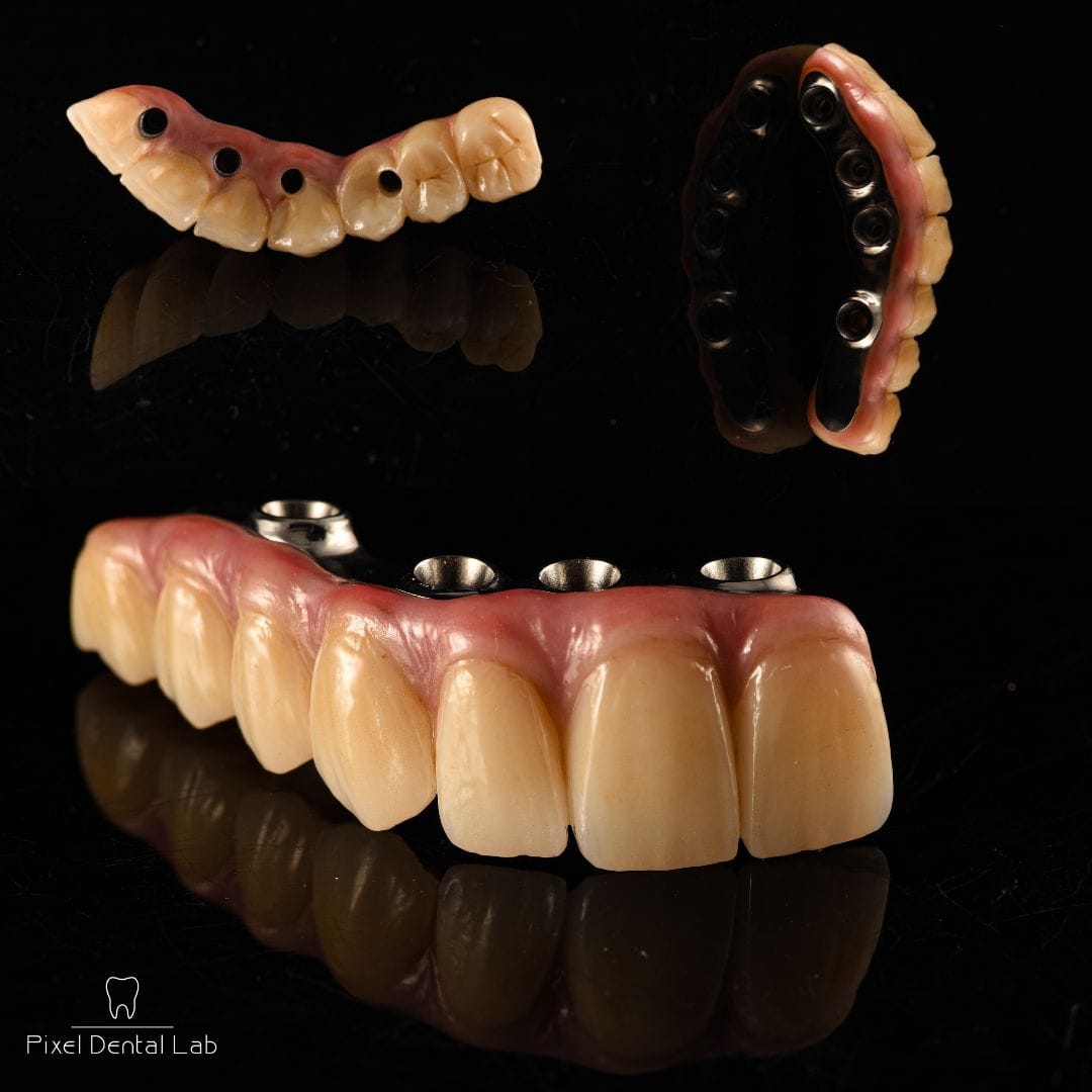 Proteze și punți dentare cu detalii naturale, culoare ivory.